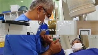 تشخیص گرفتگی عروق