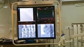 متخصص قلب و عروق در تهران