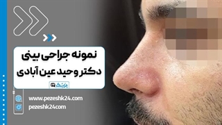 دکتر وحید عین آبادی جراح بینی در شیراز درمان جای جوش