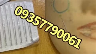 آموزش طب سوزنی زیبایی مجازی حضوری