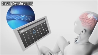 تراشه نورولینک چطوری کار میکنه؟