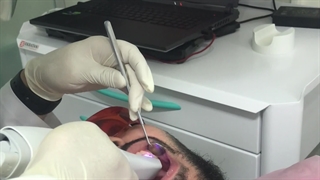 اسکنر داخل دهانی ارتودنسی
