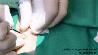 فیلم عمل کیست مویی باز - vanaklaser.ir