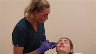 ویدئو انجام مراحل کامل پی آر پی صورت