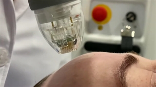 دستگاه آر اف فرکشنال ویواسه