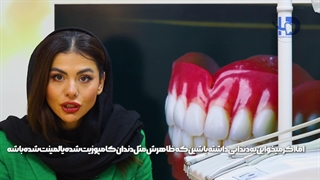 آیا دندان مصنوعی کامپوزیت می‌شود یا خیر؟