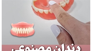 فرق دندون مصنوعی خوب و بد