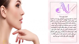 رفع غبغب بدون درد با جدیدترین تکنیک های زیبایی