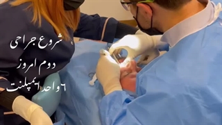 جراحی 6 واحد ایمپلنت