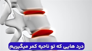 پلاتینر درمان کننده سیاتیک در منزل | تماس بگیرید : 02191324136