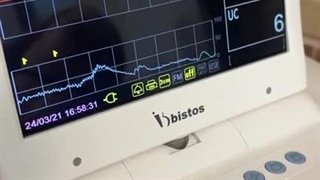 نحوه گرفتن نوار قلب جنین