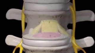 بهترین روش درمان کمر درد در منزل با پلاتینر | تماس بگیرید : 09962032839