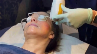 شادابی و جوانی با دستگاه جوانساز پوست