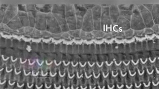 چگونه صدای بلند یا هندزفری سبب کم شنوایی و وزوز گوش می شود؟