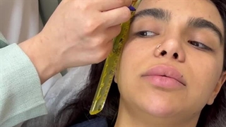 آماده سازی لیفت ابرو با نخ