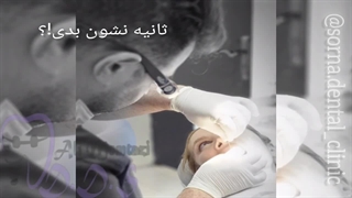 ایمپلنت و کامپوزیت