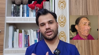5 بیماری عجیب و نادر جهان! دندانپزشکی کودکان