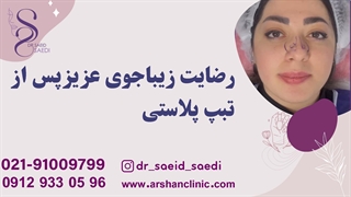 رضایت زیباجوی عزیز از تبپ پلاستی