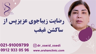 رضایت زیباجوی عزیز از ساکشن غبغب