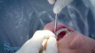 ارتودنسی دندان - بهترین کلینیک دندانپزشکی مشهد