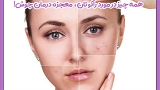 قرص راکوتان برای جوش صورت درمان سلولیت