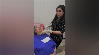 رفع غبغب (ساکشن غبغب)