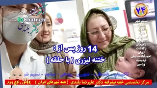 بهترین تکنیک ختنه  ( سنتی لیزری حلقه) نوزادان و کودکان ۱۴۰۳ کلینیک تخصصی ختنه دکتر بلندی