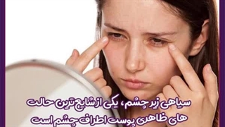 درمان سیاهی و گودی زیر چشم