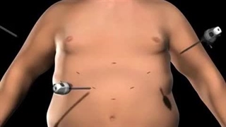 مراحل عمل اسلیو