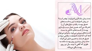 لیزر اندولیفت برای جای جوش | هزینه ، مزایا و عوارض پر کردن دندان