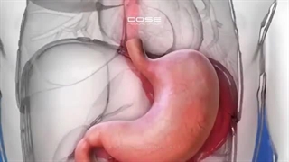 بوتاکس معده