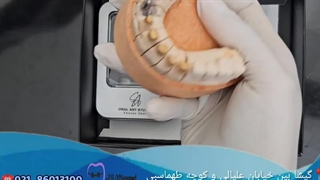 6 واحد ایمپلنت