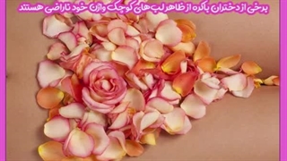 عمل لابیاپلاستی برای دختر باکره