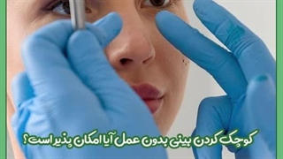 آیا می توان بدون جراحی بینی را کوچک کرد؟