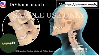 گردن درد و دیسک گردن