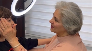 تزریق فیلر به زیر چشم و خط خنده