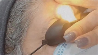 پاک کردن تتو ابرو