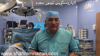 جراحی لاپاروسکوپی تومورهای معده