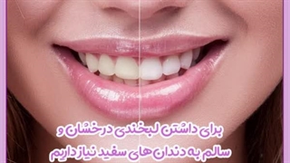 کامپوزیت به جای بلیچینگ