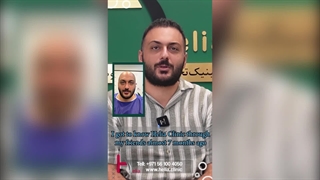 Fantastic hair transplant results 7 months after treatment at Helia Clinic