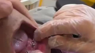 فیلم دندان اوردنچر