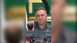 The Hair Transplant Journey to Achieving Thick and Ideal Hair in Only 8 Months