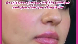چگونه نتایج دلخواه از عمل چال گونه داشته باشیم ؟