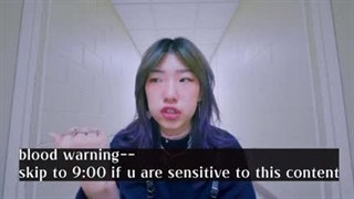 Personal Growth Journey ep1_ MY TONSIL REMOVAL SURGERY & related FAQ