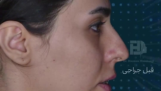 فیلم جراحی همزمان دو فک و چانه