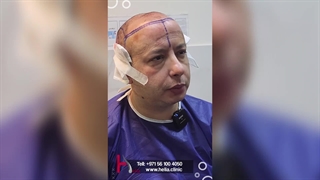 Conversation with a patient from Helia Clinic