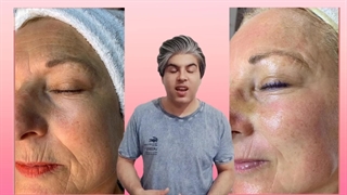 خرید مینی هایفو| نمایندگی مینی هایفو| آموزش مینی هایفو