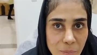 فیلر زیرچشم در کلینیک نجلا فردیس