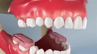 اپن بایت قدامی