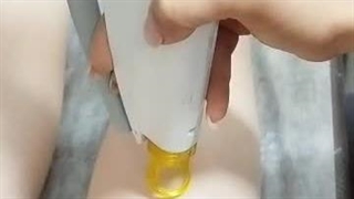 لیزر با دستگاه الکساندرایت کندلا فردیس